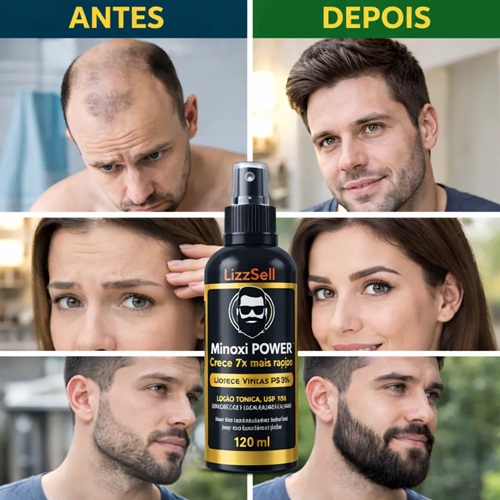 Minoxi Power Crescimento Capilar E Ante Queda Minoxipower